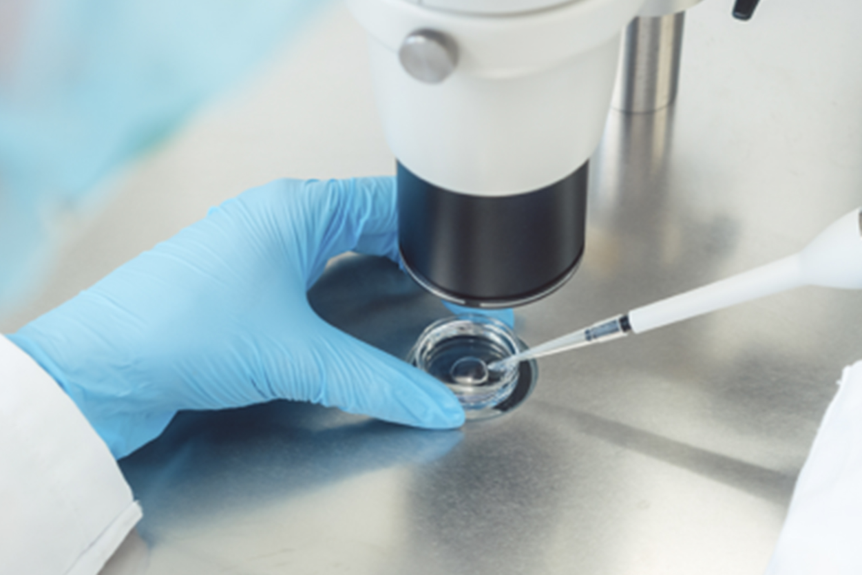 Fertilizao In Vitro