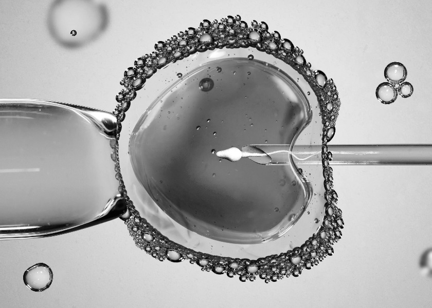 Etapas da Fertilizao in Vitro com ICSI